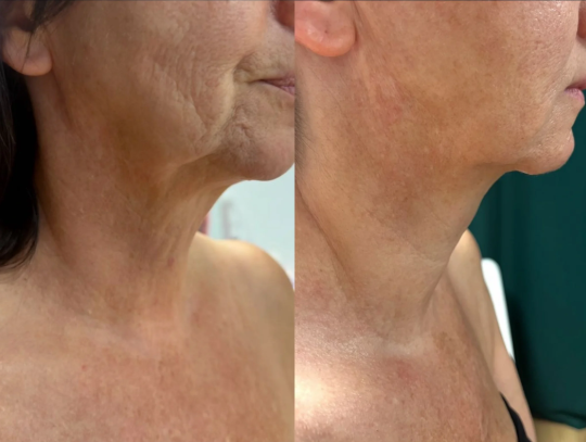 Efekt Pani Małgosia